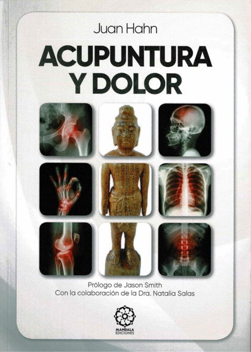 ACUPUNTURA Y DOLOR