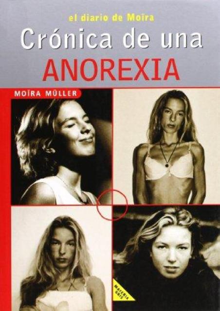 ANOREXIA CRONICA DE UNA