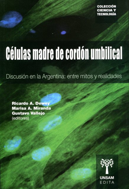 CELULAS MADRE DE CORDON UMBILICAL