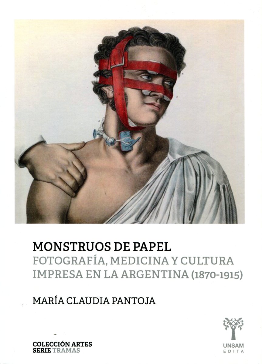 MONSTRUOS DE PAPEL .FOTOGRAFIA , MEDICINA Y CULTURA IMPRESA EN LA ARGENTINA